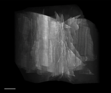 Peter Kner et al., Ausschnitt aus Super-resolution video microscopy of live cells by structured illumination, 2009, © Macmillan Publishers Ltd: Nature Methods, 2009 Hannah Black - Small Room