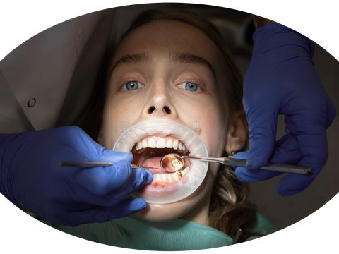 Nahaufnahme eines geöffneten Mundes einer Person mit Zahnspiegel und Sonde, die von Händen mit blauen Handschuhen gehalten werden