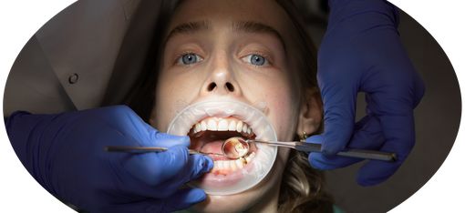 Nahaufnahme eines geöffneten Mundes einer Person mit Zahnspiegel und Sonde, die von Händen mit blauen Handschuhen gehalten werden