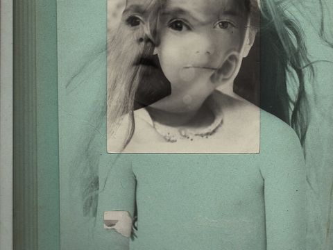 Ein Kinderkopf.